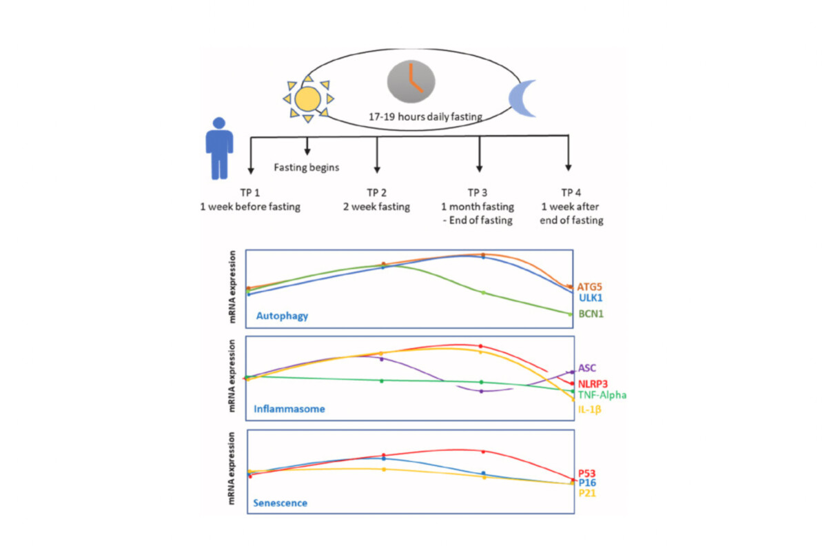 View of Intermittent Fasting - The Impact on Autophagy, Inflammasome, and ...
